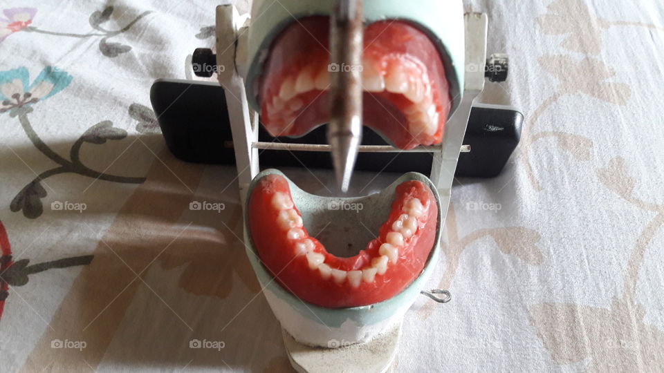 Teeth setting occlusions