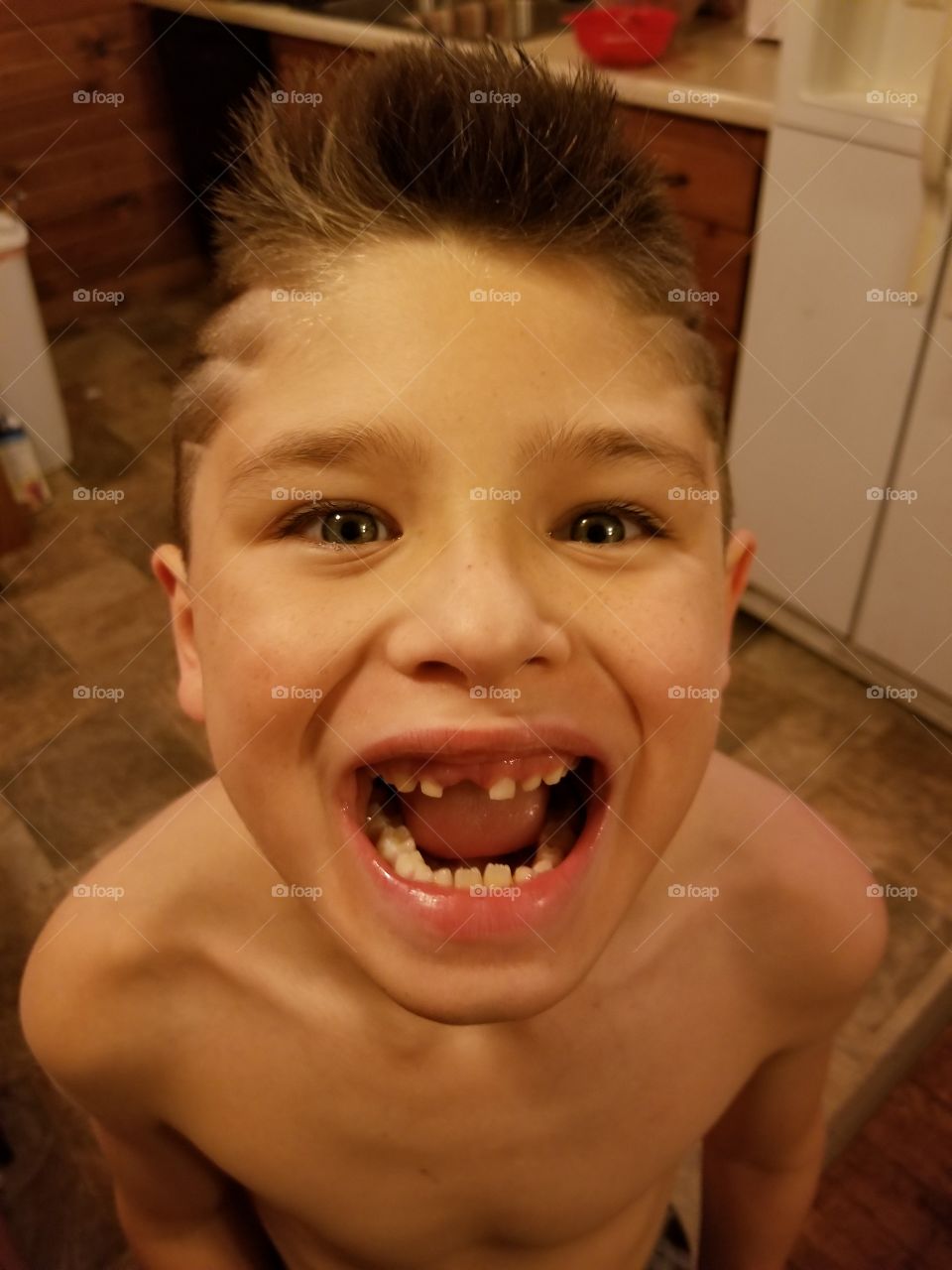 Lost Tooth