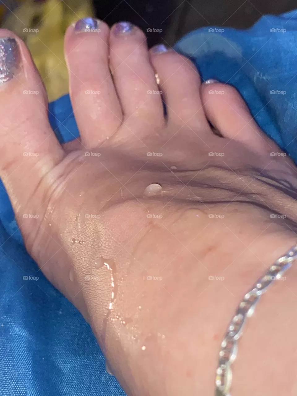 Wet feet