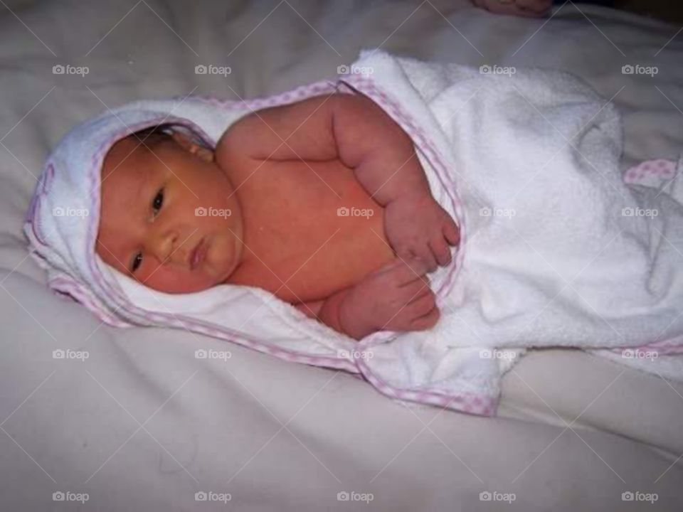Newborn with jaundice laid in a blanket. 

Jaundice is caused by the build-up of bilirubin in the blood. Bilirubin is a yellow substance produced when red blood cells are broken down. Jaundice is common in newborn babies because babies have a high level of red blood cells in their blood, which are broken down and replaced frequently.