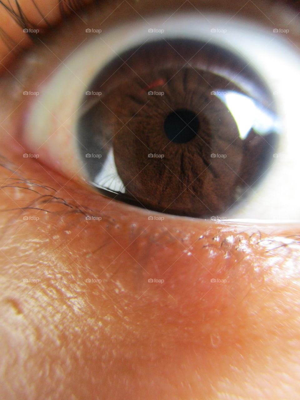 iris eye