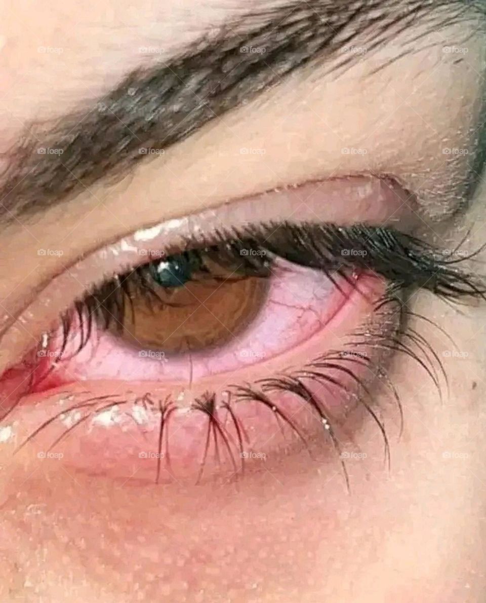 A close-up photo of my eye.