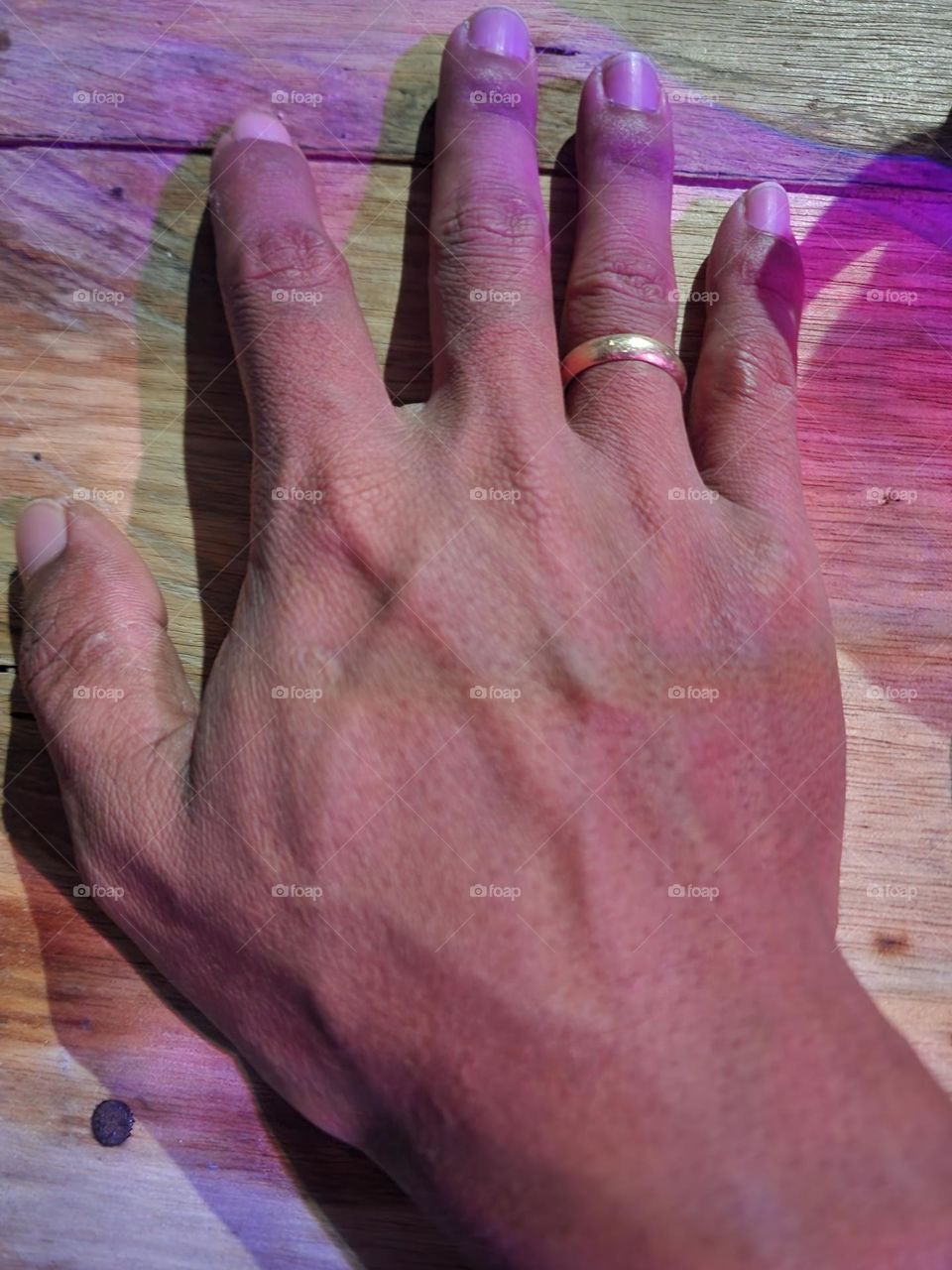 Editors' Choice : This is a photo of my hand that I took on Wednesday night, April 28, 2022