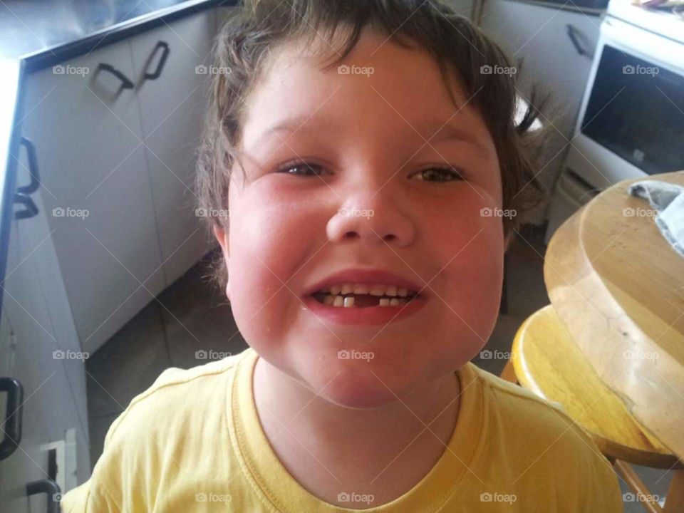 Part of life is loosing your teeth. My son shows me his gaps. The tooth fairy will be very busy.