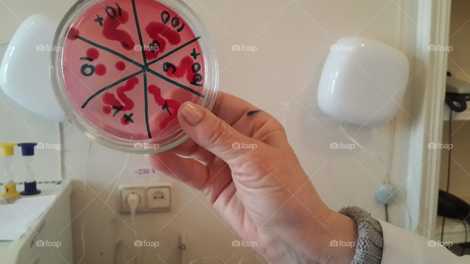 Hand holding petri dish number for reserch