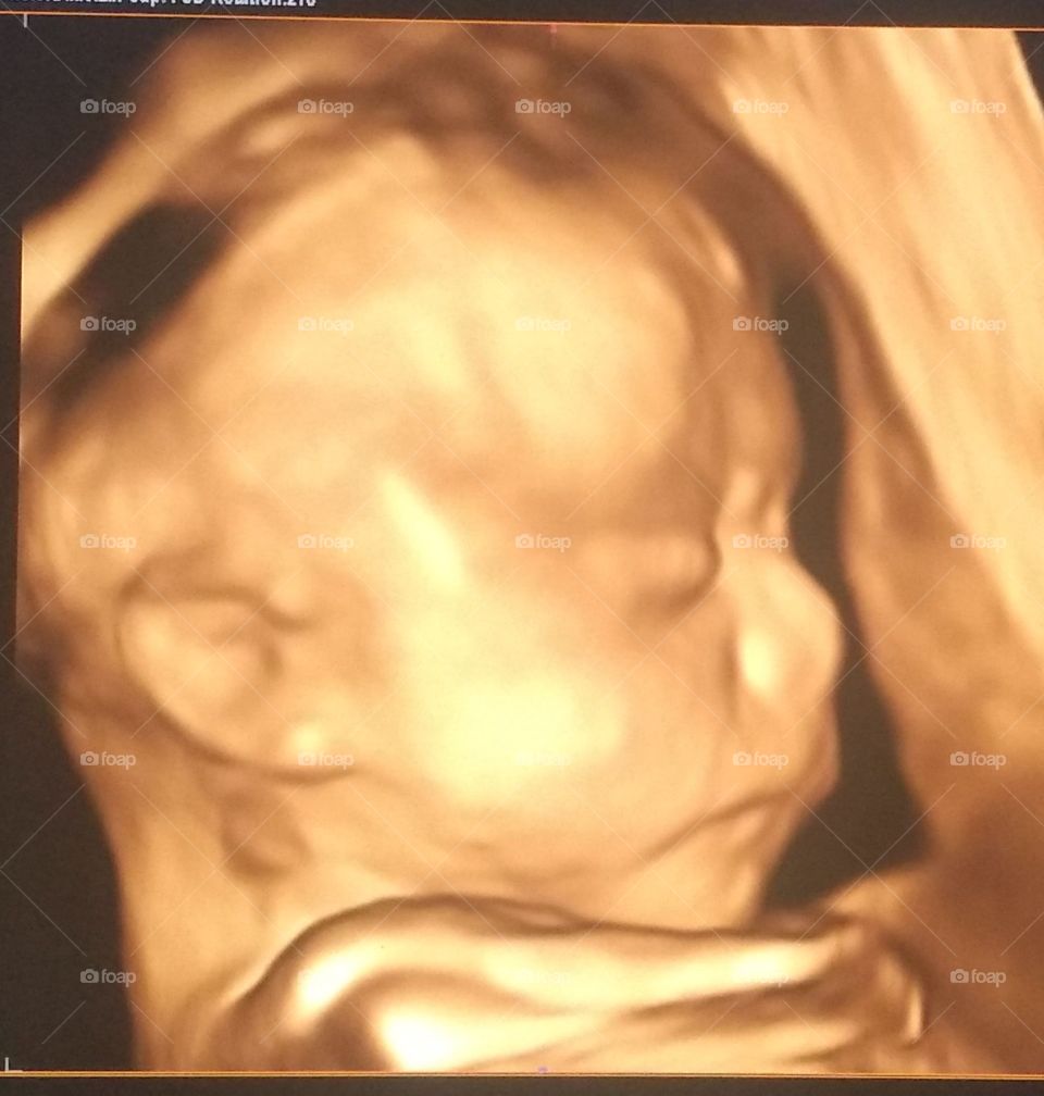 bebé en el vientre de mami