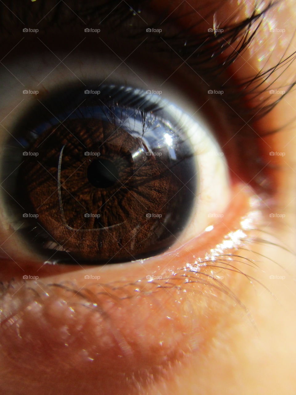 iris eye