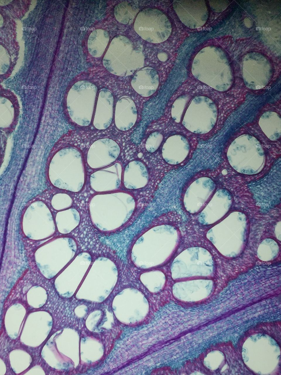 Microscope lens kit with smart phone show detail of cactus section