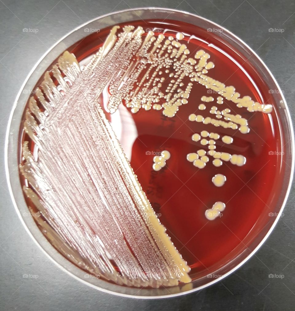 Staphylococcus aureus