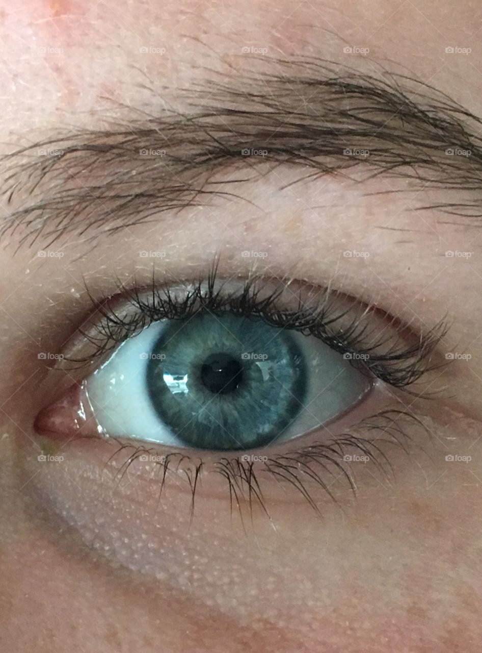 Blue eye