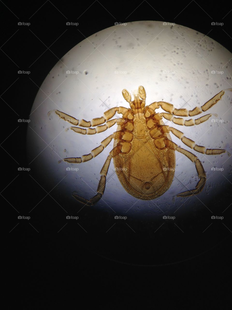Ixodes (tick) male under microscope