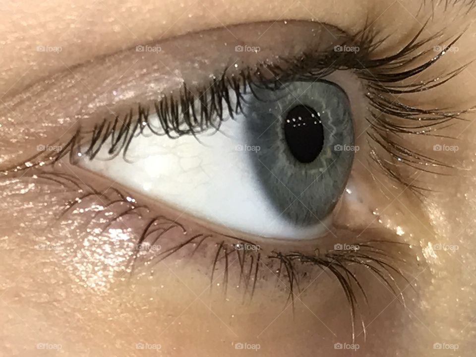 Eyeball 