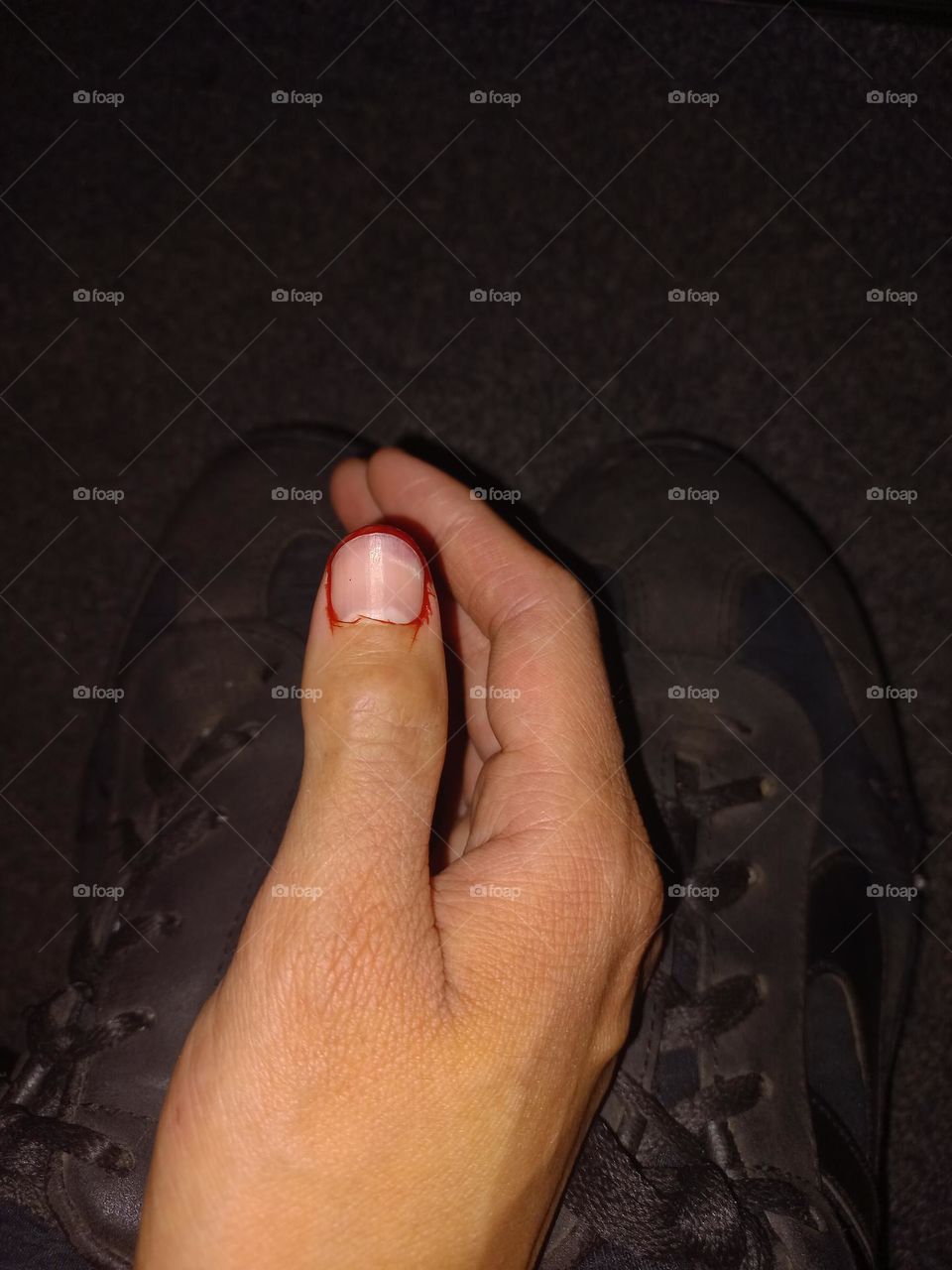 Eso dolió demasiado.