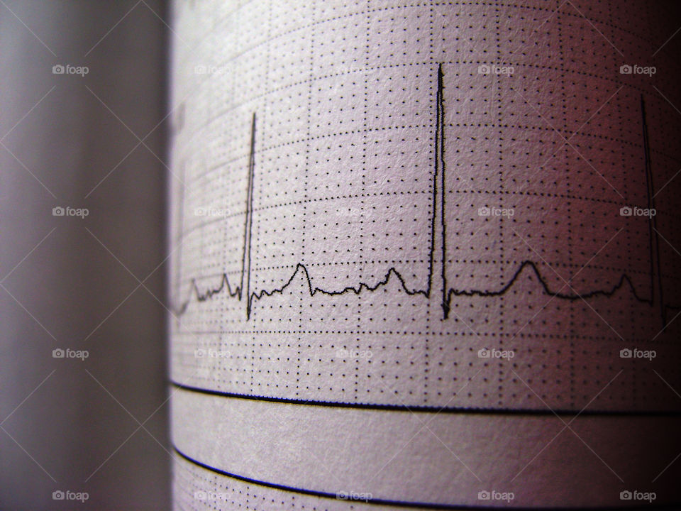 Sinus Heart Rhythm On Electrocardiogram Record Paper Showing Normal P Wave, PR and QT Interval and QRS Complex, EKG paper