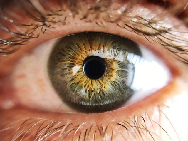 Eye