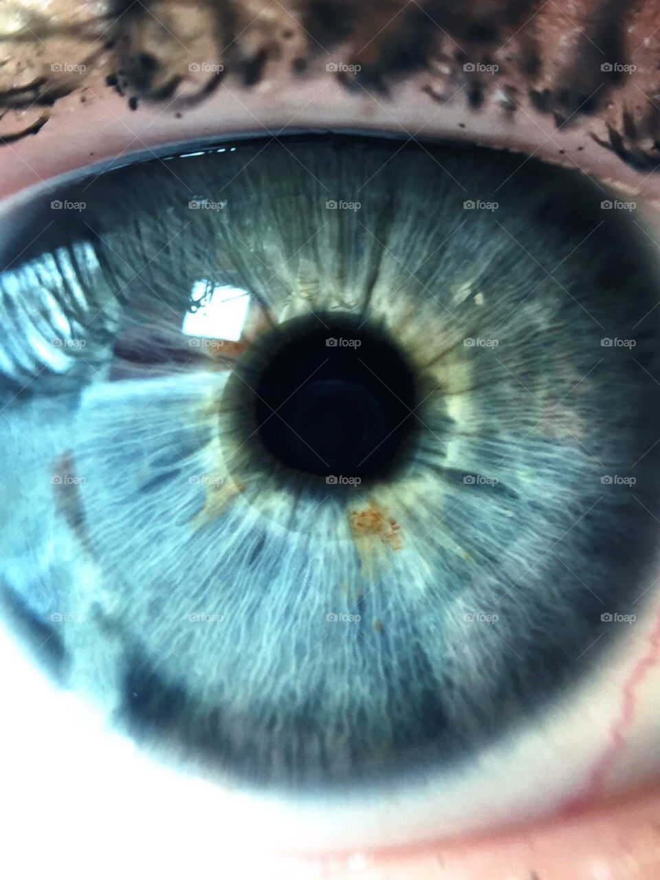 Eye