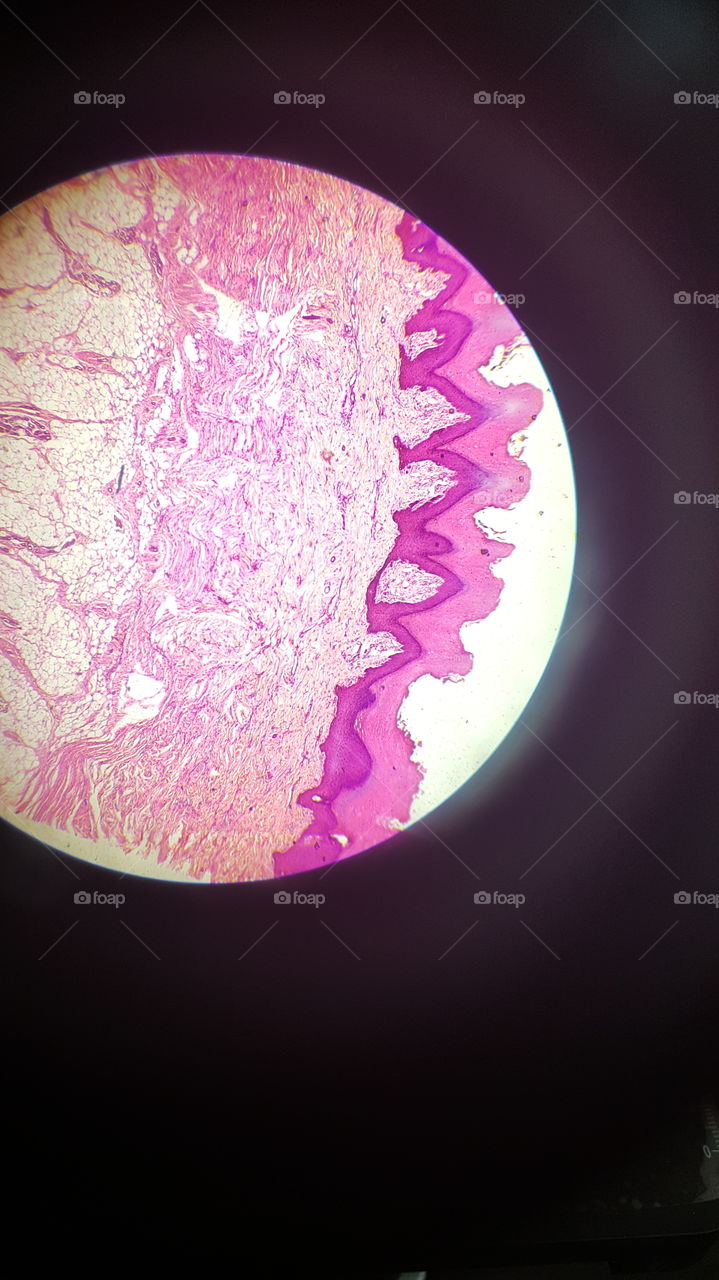 Thick skin under microscope
