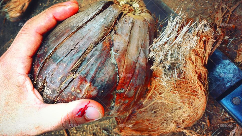 Atenção; acidente, perigo, corte no dedo, sangue...