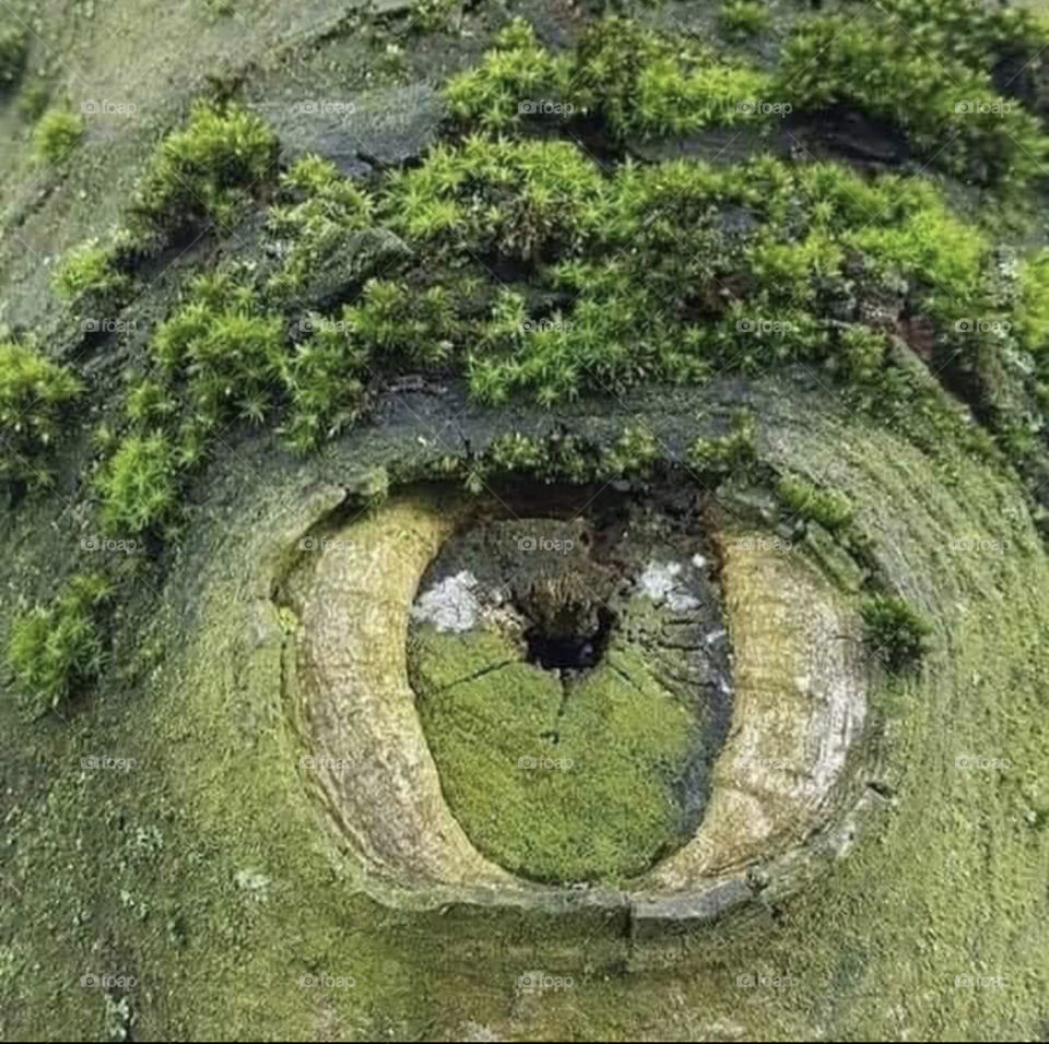 Eye 