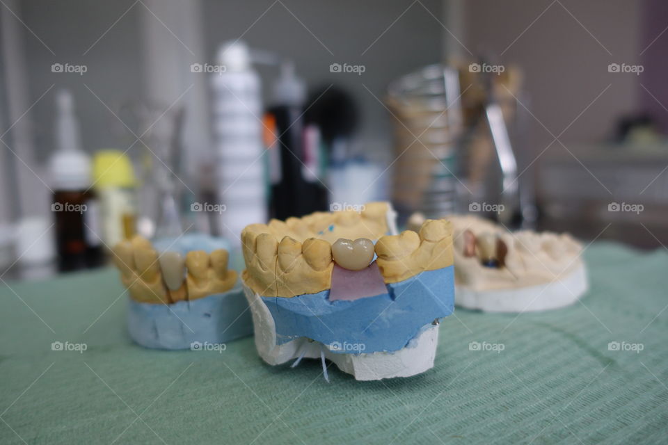 Dental crown implantant