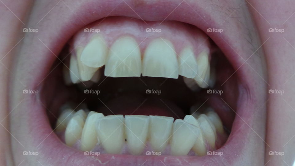 teeth