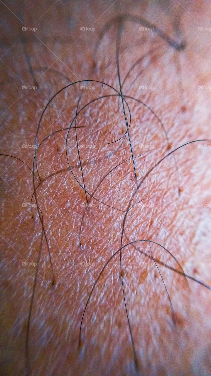 leg hair