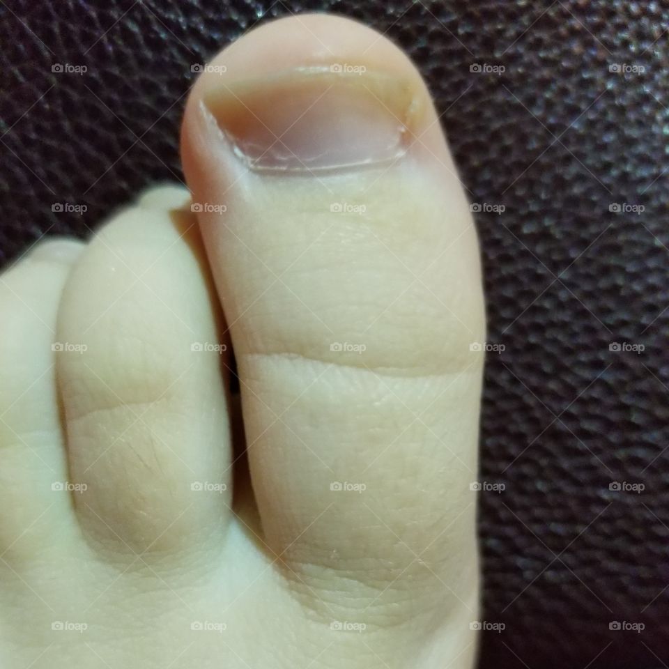 Big toe