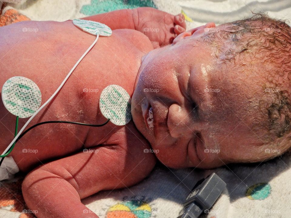 Newborn Infant
