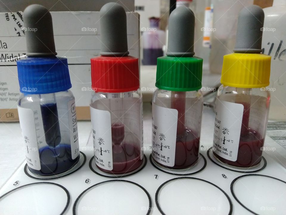 widal test chemical typhoid blood test