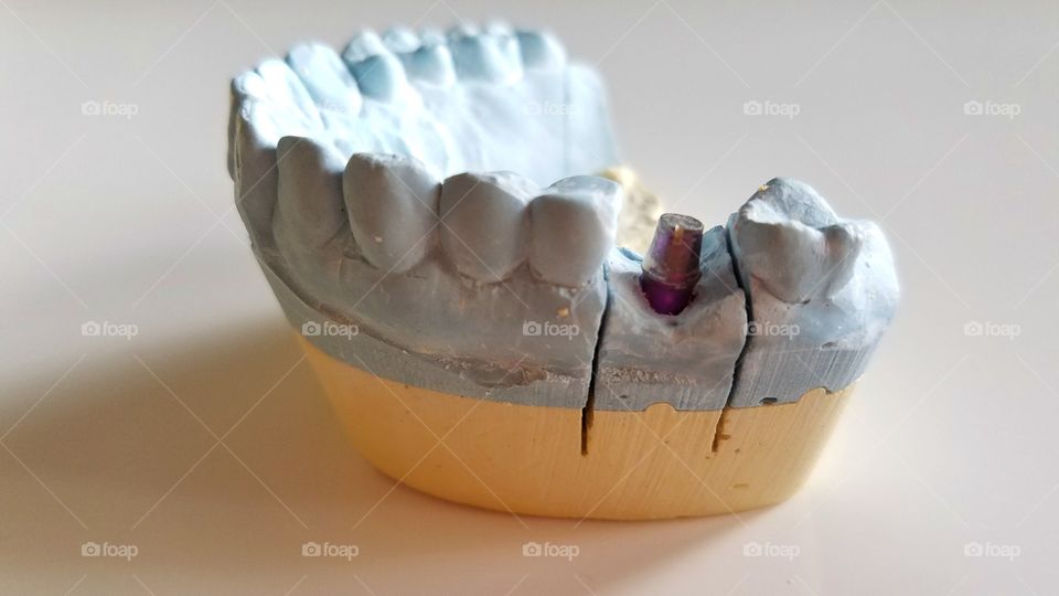 Dental impressions