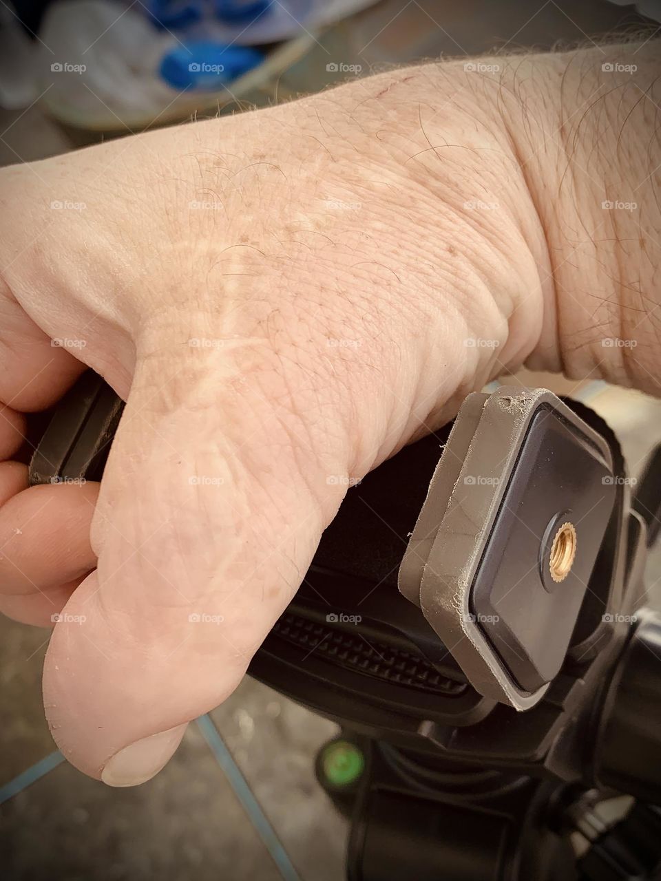 Holding Tripod Testing Outside With Repaired Thumb Replaced By A Toe Working With Scares Under The Sunlight.