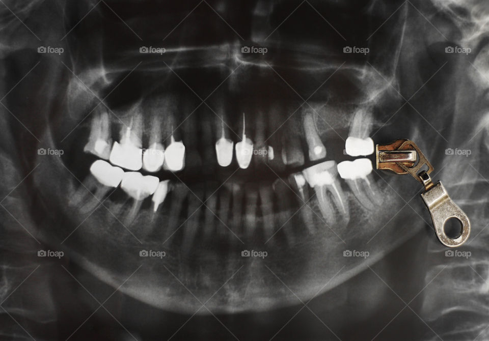 Abstract concept. X-ray photo of teeth and real zipper.