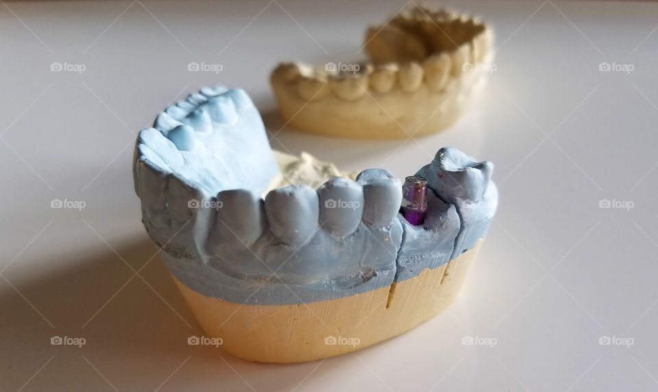 Dental impressions