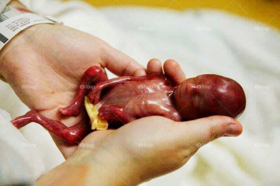 5-month-old finger boy