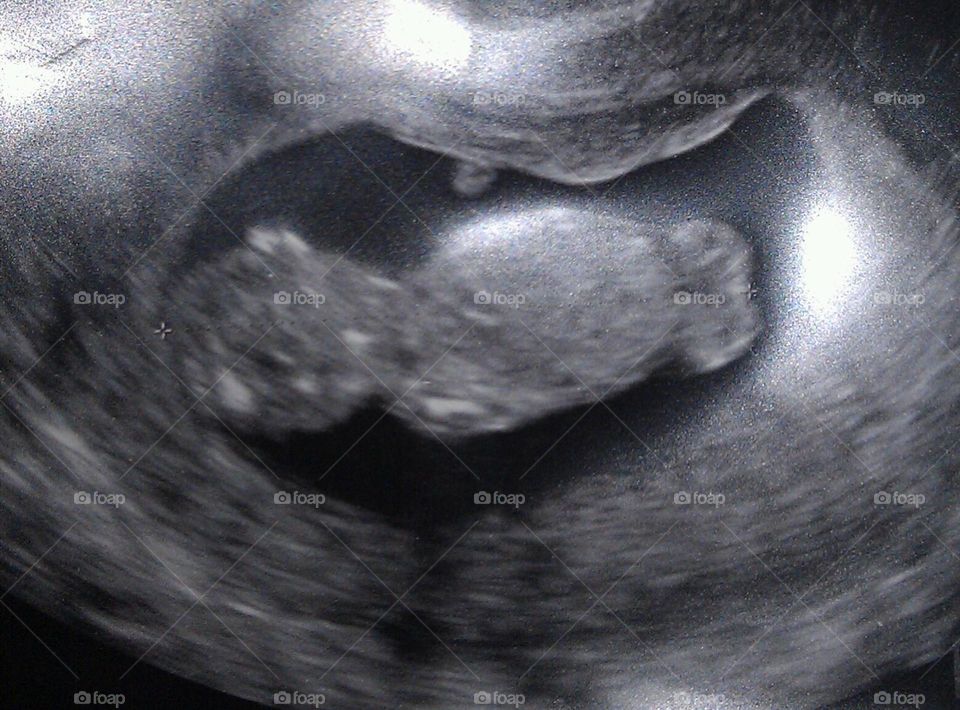 Womb baby