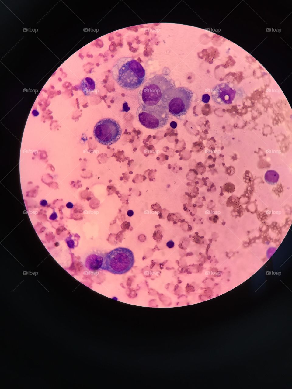 Mesothelial cell
