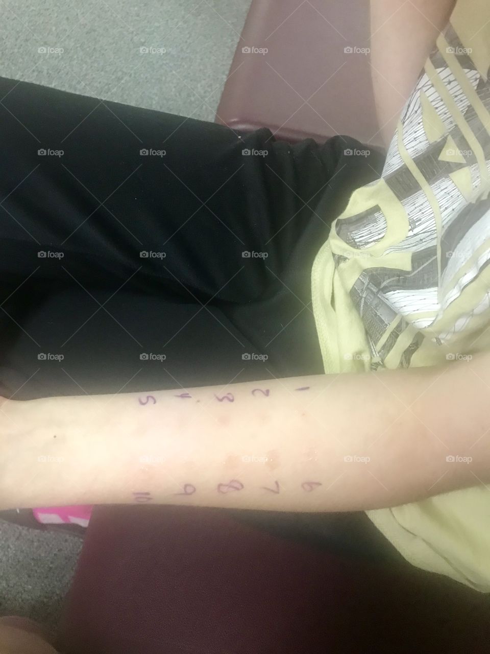 Allergy testing