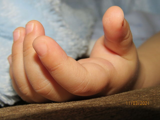 Hand 🤚🏻