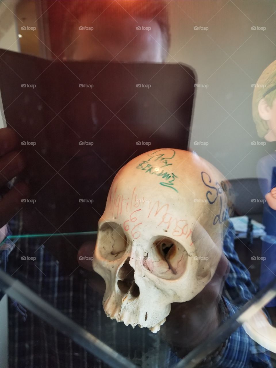 Marilyn Manson autographed real handicapped man's skull