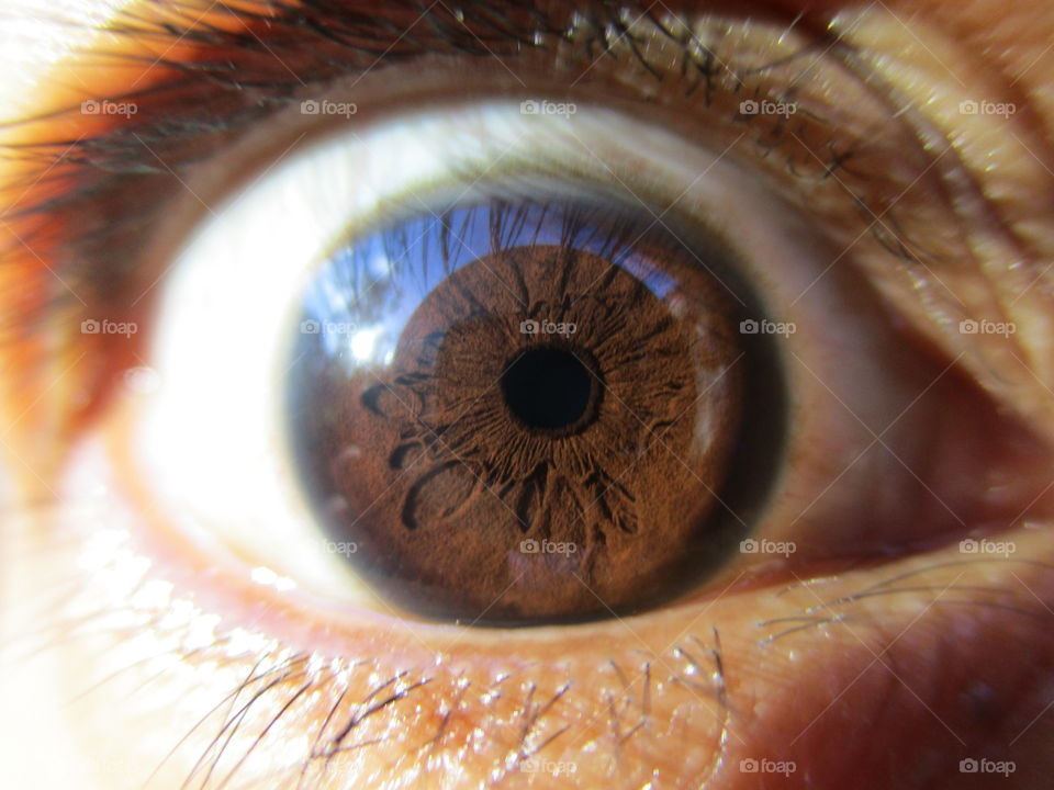 iris eye