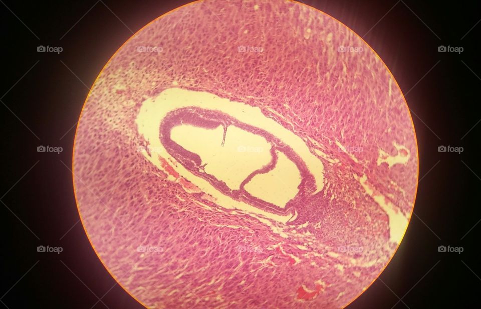 Mouse uterus as seen trough microscope