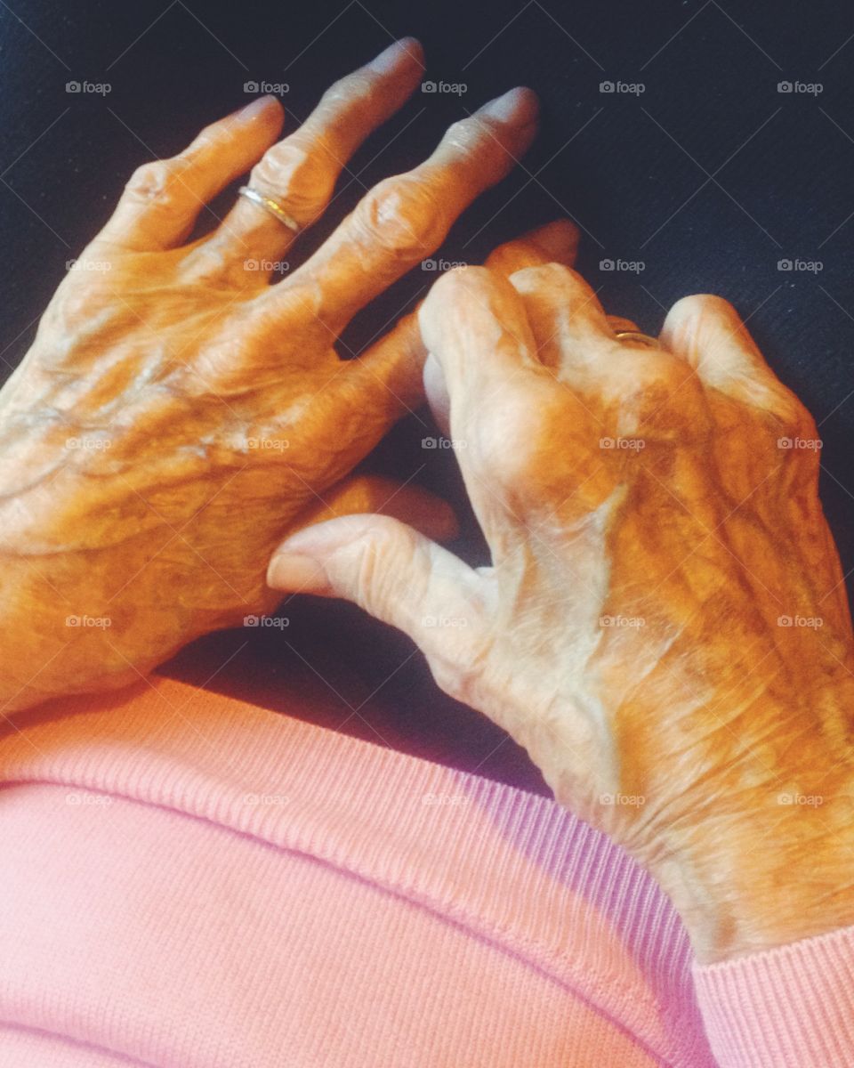 101 year old hands