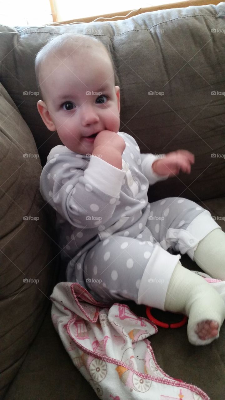 infant girl with casts sitting get on a couch