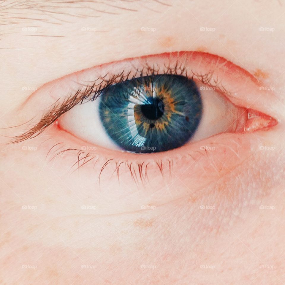 Eye