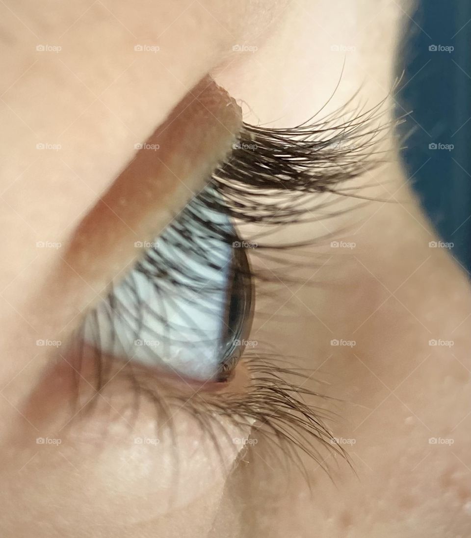 my eye