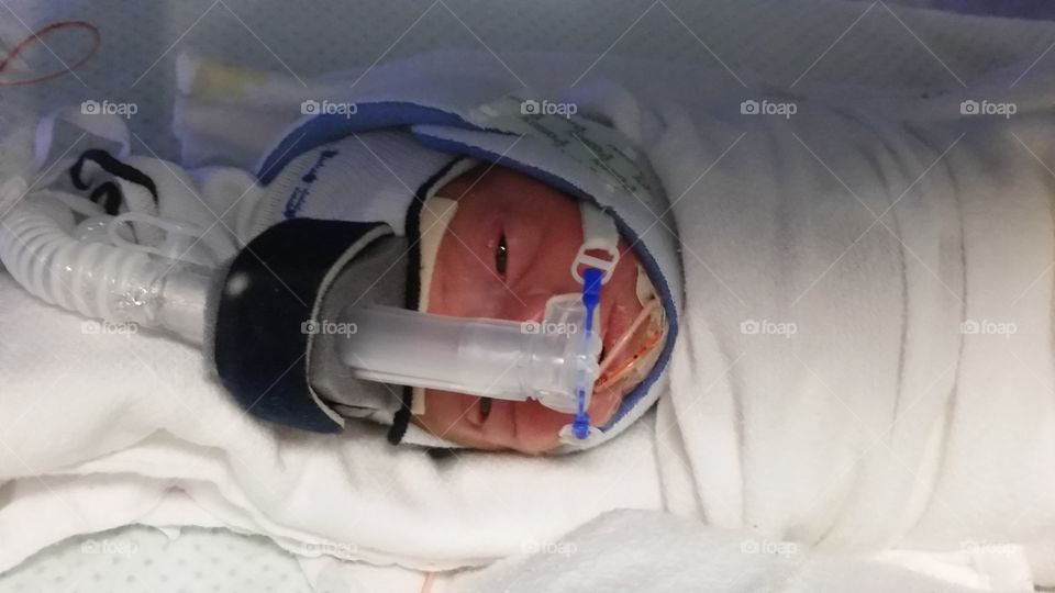 Newborn premature sick baby in intensive care unit