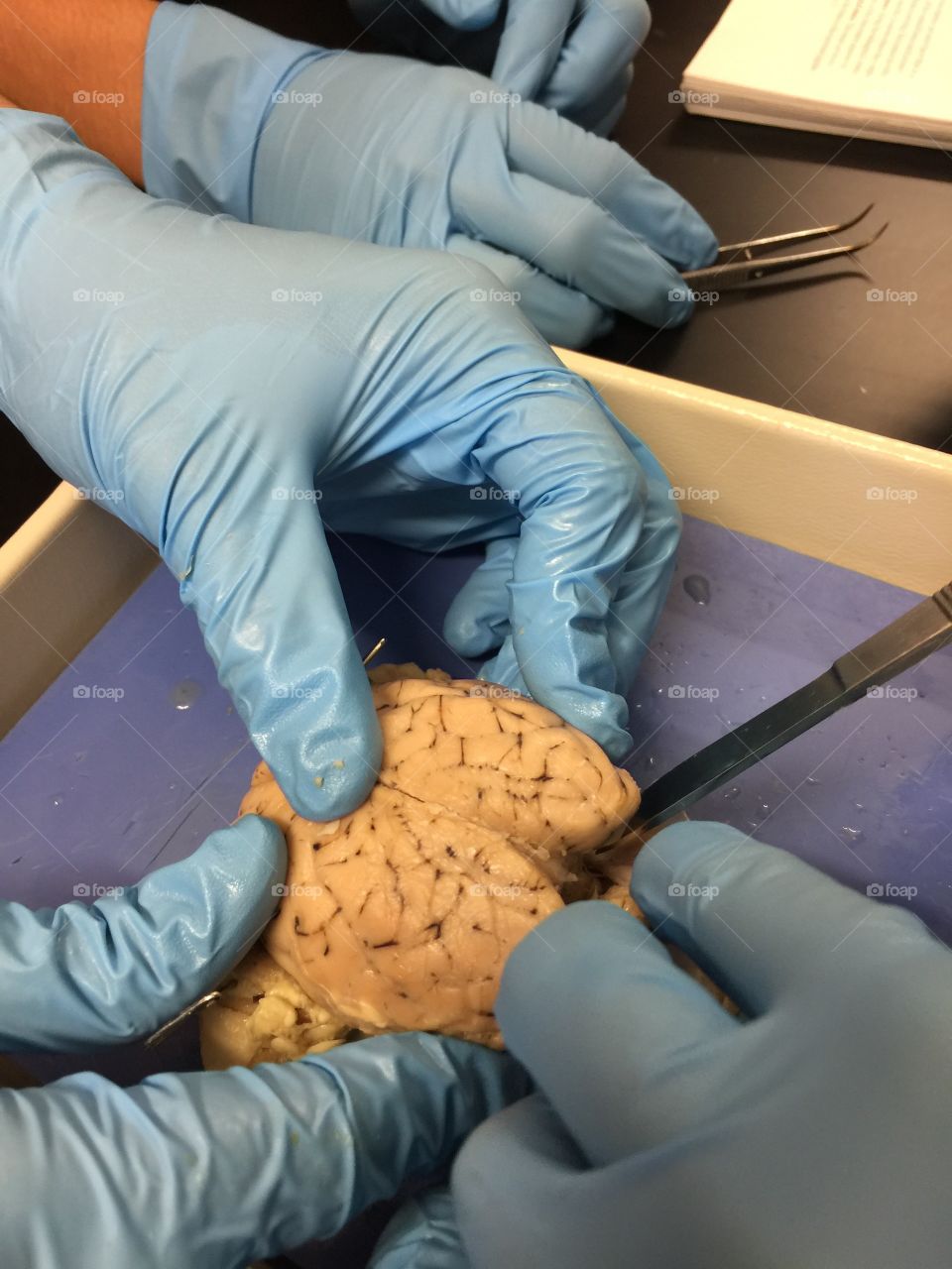 Brain Dissection 