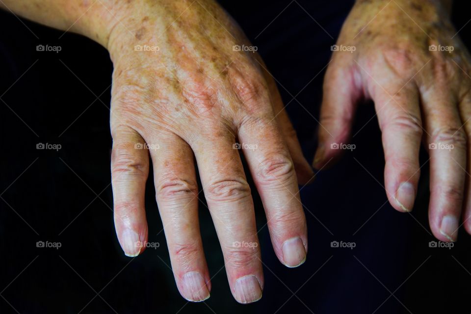 Grandads hands 