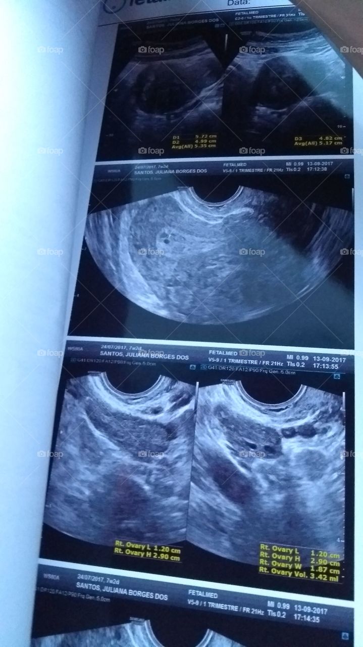 Radiography, Ultrasound, Fetus, Technology, Scanning
