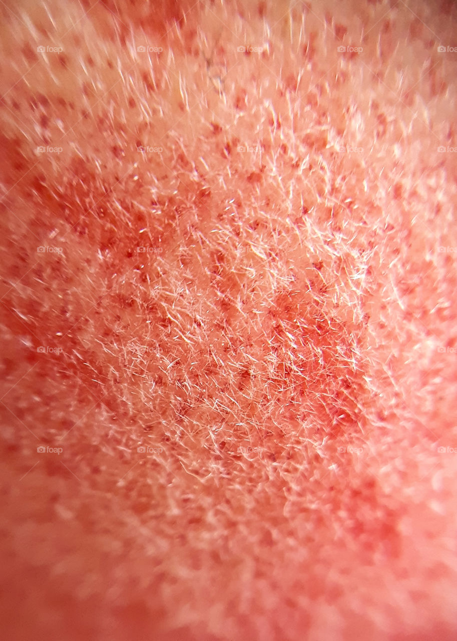 skin of peach (macrophoto)